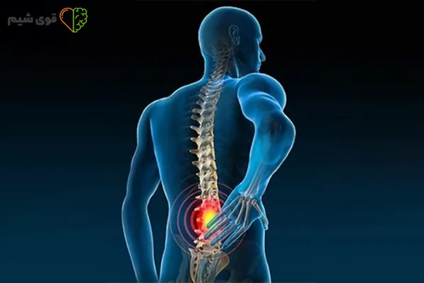 ورزش برای درد سیاتیک