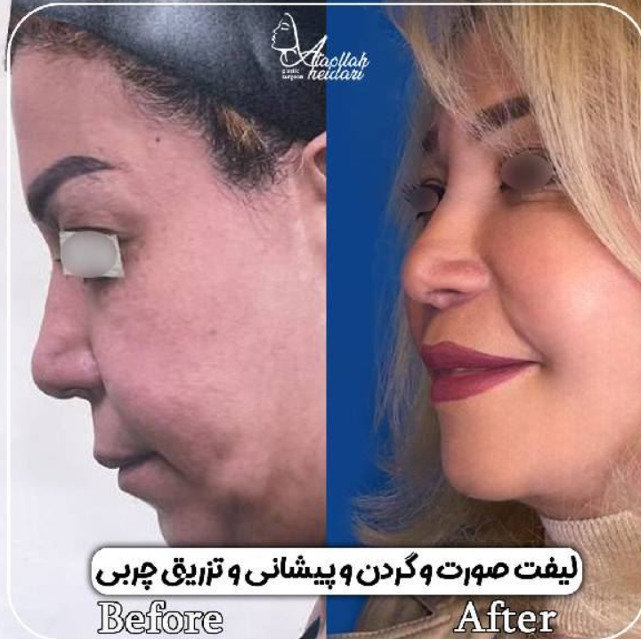 scxidyUCGF14CPtsnxadIDBjpfz31y2QtBWyRwp2