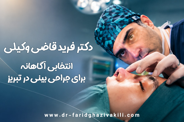 جراح بینی تبریز دکتر فرید قاضی وکیلی