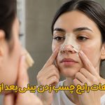 چسب زدن بینی بعد از عمل | دکتر علیرضا محبی