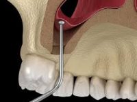 8fAuPMNHt74fqi57sF8VlM7Ey9WrKgDAbu6Gro15