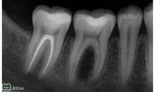 LlIKnWKOn3g2u3d44lOP7KkJnBlqXVtFXUVitcWc