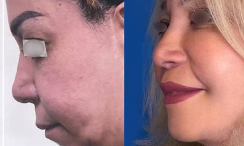 scxidyUCGF14CPtsnxadIDBjpfz31y2QtBWyRwp2